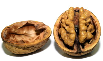 alzheimerova choroba